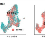 간섬유화 진행 단계별 발병기전 규명