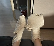 장재인 화상 부상 “양 발 치료, 긴 기간 붕대 감고 지내” [DA★]