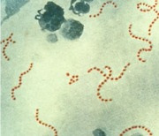 英, 패혈증 세균 확산…어린이 최소 16명 사망 '비상'