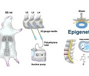 "퇴행성 허리디스크, 유전보단 후천적 노화 간 연관성 발견"