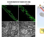 고칼로리 식이에 의한 당뇨병 발생 기전 첫 규명