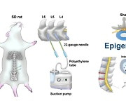 “퇴행성 허리디스크, 유전이기보다 후천적 노화와 밀접”