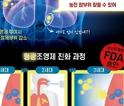 암 찾아가는 ‘형광물질’ 주입해 수술 정확도 높인다 [헬스컷]