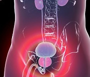 '이 암' 통증·감염 위험있는 조직검사 대신 MRI 로