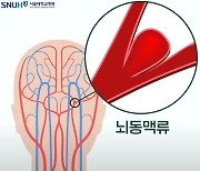 망치로 세게 맞은 느낌…겨울 더 위험한 '머릿속 시한폭탄' 정체