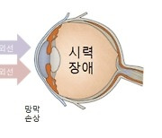 이번 주말 '겨울눈꽃' 구경 계획 있다면…고글 필수, 왜?