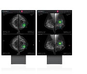 루닛, 3차원 유방암 검진 AI 솔루션 식약처 수출 허가