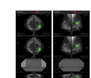 루닛, 3차원 유방암 검진 AI 솔루션 식약처 수출허가 획득
