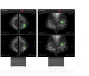 루닛, 3차원 유방암 검진 AI 솔루션 식약처 수출허가 획득