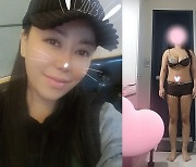 50억 자랑한 '나솔' 정숙, 복부지방 제거 수술…달라진 몸매 눈길