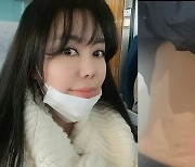 '50억 자산가' 10기 정숙, 복부시술 사진인증…최근 결별설도