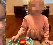 “시력 잃을뻔했다” 딸 공격한 ‘반려닭’ 너깃으로 만든 엄마 논란