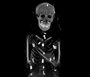 2300년전 이집트 소년 미라 CT 찍어보니…온몸에 부적 49개