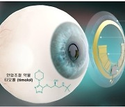 "안압 따라 약물 투여"…녹내장 치료 스마트 콘택트렌즈