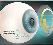 녹내장 안압 진단·치료 한번에… 국내 연구진, 스마트 콘택트렌즈 개발