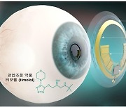 ‘눈에 끼워 녹내장 안압 진단·치료’ 콘텍트렌즈 나왔다