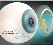 눈에 끼우면 녹내장 안압 진단·치료…스마트 콘택트렌즈 개발