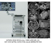 초소형 디지털 조직진단 장비 cCeLL을 통한 ‘수술 중 실시간 뇌종양 진단’ 가능