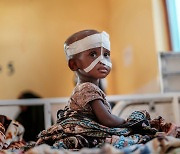 [위클리 포토브리핑] 영양실조 걸린 에티오피아 어린이... 지난 주 베스트 사진 10장