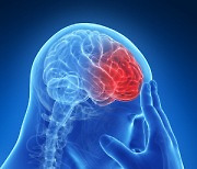 두통 심한데, 건강보험 되는 'MRI 검사' 받을 수 있나?