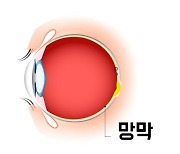 [건강톡톡] 고혈압 오래 앓으면...눈 속 망막에도 치명타