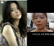 '이수근♥' 박지연, "'내 얼굴 아닌데'라 부정해"…스테로이드 부작용 전후 공개