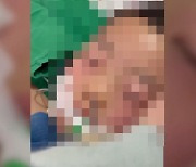아파트 수영장서 강습받다 뇌사… 6세 아들 모습 공개한 부모