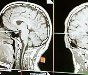 7월부터 의원급 이상 CT·MRI·PET 검사 적정성 여부 검토