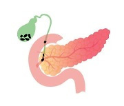 담낭 제거하면 당뇨병 발병 위험 20% 증가