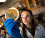 항생제 사용 많은 나라, 뱃속 내성 세균 많다...세계 최대 규모 연구서 밝혀