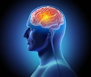 ‘뇌백질 변성’이 뇌경색·치매처럼 위험할까?