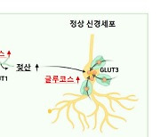 뇌 영상 하나로 `알츠하이머 치매` 조기진단 길 열린다