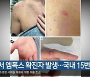 경북서 엠폭스 확진자 발생…국내 15번째