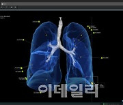 코어라인소프트 ‘AVIEW’ 브라질 시판전 허가 획득