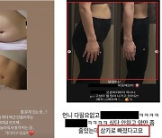 “2㎏ 빠졌다?”…인플루언서 허위 광고에 속지 마세요