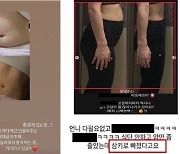 “벌써 2kg 빠졌어요” 인플루언서 ‘거짓말’ 무더기 적발