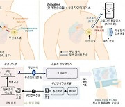 무선으로 심혈관 환자 상태 실시간 진단