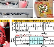 외부자극 인지 소프트로봇·심장질환 진단 전자소자 구현