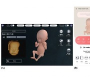 뱃속 태아 VR로 보여주니..."산모, 태아와의 유대감 강해졌다"