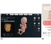 "VR로 태아 미리보기"..산모·태아 유대감 강해진다
