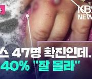 엠폭스 또 5명 확진…국민 40% “아는 게 없어” [오늘 이슈]