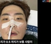 [종합] '괴사성 췌장염' 송필근 "장기가 녹은 상황…배 구멍 7개·17cm 절개"