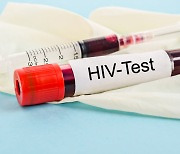 프랑스, HIV감염자도 군입대 가능…"더이상 차별 기준 아니다"