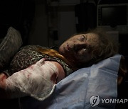 '퓰리처상 수상작' 공습에 앰뷸런스 실려 가는 우크라 여성