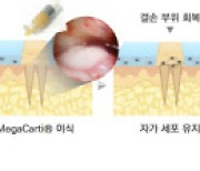 엘앤씨바이오,메가카티 조기출시 사상 최대실적 자신