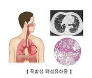 위-식도 역류, 폐 섬유화 위험↑