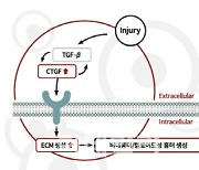 올릭스, 비대흉터 치료제 다수 기업과 기술수출 논의중