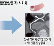 젊은층도 대사증후군 4개 이상땐 심혈관 석회화 진행 4.6배↑