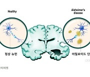 독ㆍ미 연구팀 "알츠하이머 예방 변이유전자 발견"