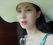 서현, 이런 모습 처음 “과식해서 퉁퉁 부어”